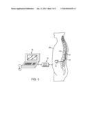 NEUROSTIMULATION SYSTEM WITH THREE-DIMENSIONAL LEAD MIGRATION DETECTION     AND AUTOMATIC NEUROSTIMULATION CORRECTION diagram and image