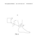 MINIMALLY INVASIVE IMPLANTABLE NEUROSTIMULATION SYSTEM diagram and image