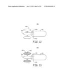 MINIMALLY INVASIVE IMPLANTABLE NEUROSTIMULATION SYSTEM diagram and image