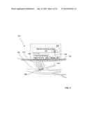 METHOD AND SYSTEM FOR BLOCKING NERVE CONDUCTION diagram and image