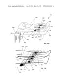 METHOD AND SYSTEM FOR BLOCKING NERVE CONDUCTION diagram and image