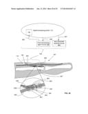 METHOD AND SYSTEM FOR BLOCKING NERVE CONDUCTION diagram and image