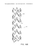 PREFORM FOR AND AN ENDOLUMINAL PROSTHESIS diagram and image