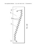 PREFORM FOR AND AN ENDOLUMINAL PROSTHESIS diagram and image