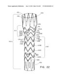 PREFORM FOR AND AN ENDOLUMINAL PROSTHESIS diagram and image