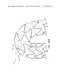 PREFORM FOR AND AN ENDOLUMINAL PROSTHESIS diagram and image