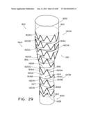 PREFORM FOR AND AN ENDOLUMINAL PROSTHESIS diagram and image