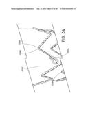 PREFORM FOR AND AN ENDOLUMINAL PROSTHESIS diagram and image