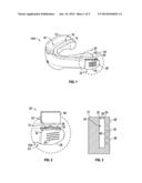 MOUTHGUARD FOR THE DELIVERY OF ACTIVE INGREDIENTS diagram and image