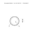 ADJUSTABLE PROCESS SPACING, CENTERING, AND IMPROVED GAS CONDUCTANCE diagram and image