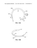 Packaging for Surgical Needle Cartridge and Suture diagram and image