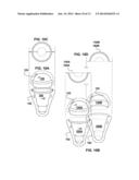 RECLOSABLE MULTI-PART BLISTER diagram and image