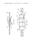 Packaging Material and Method for Microwave and Steam Cooking of Food     Products diagram and image