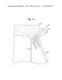 RECEPTACLE WITH CINCH diagram and image