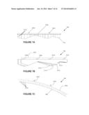 Suspended Architectural Structure diagram and image