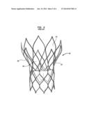 DIPPING MANDREL WITH A GAP diagram and image