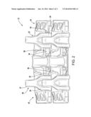 TRACK SHOE AND PIN REMOVAL SYSTEM diagram and image