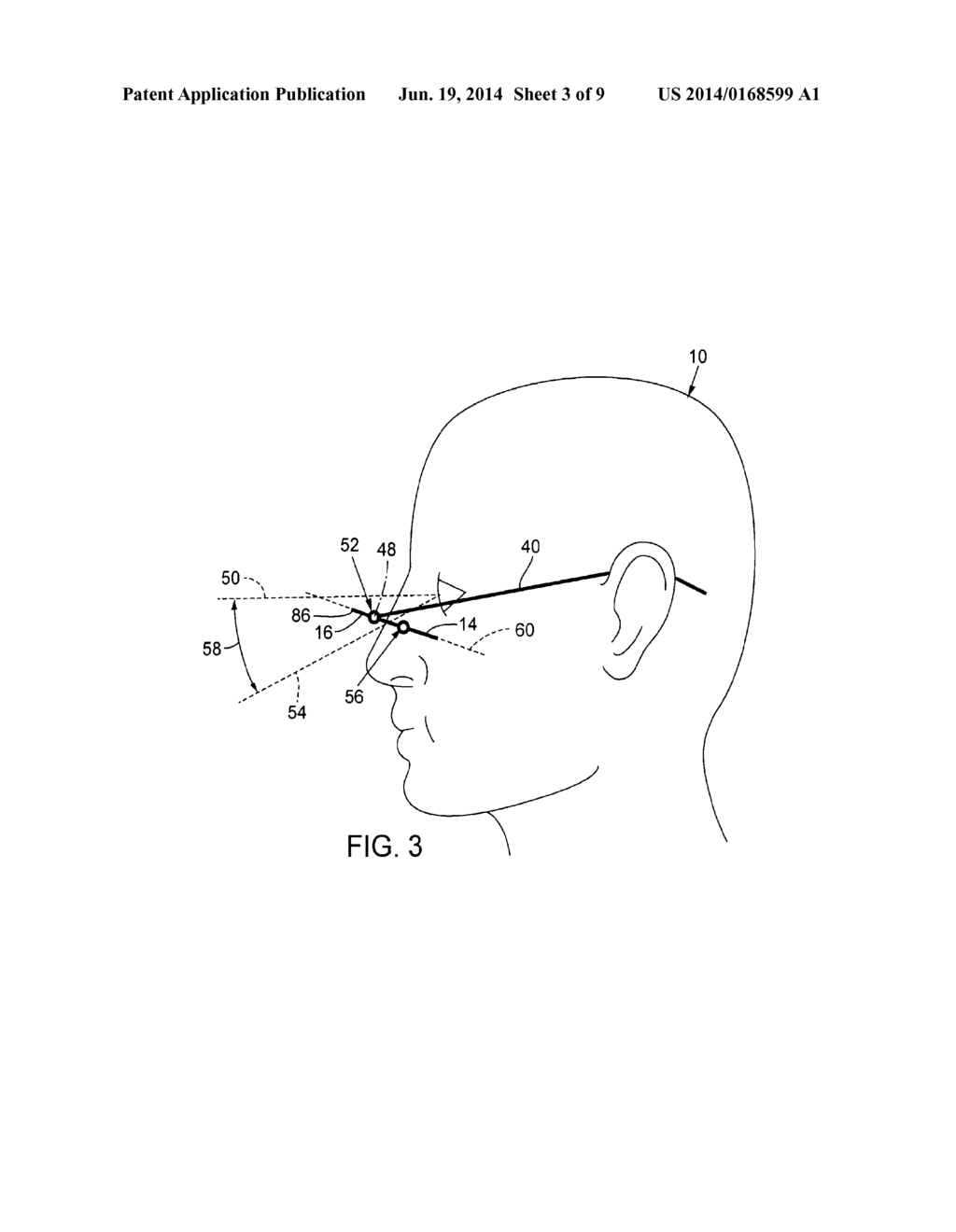 ADJUSTABLE EYEWEAR - diagram, schematic, and image 04