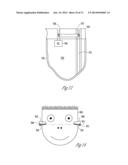 HEARING ASSISTANCE DEVICE VENT VALVE diagram and image