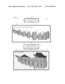 INTEGRATION OF INTRA-ORAL IMAGERY AND VOLUMETRIC IMAGERY diagram and image