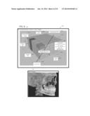 INTEGRATION OF INTRA-ORAL IMAGERY AND VOLUMETRIC IMAGERY diagram and image