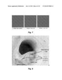 BIOMARKER FOR CORONARY ARTERY DISEASE diagram and image