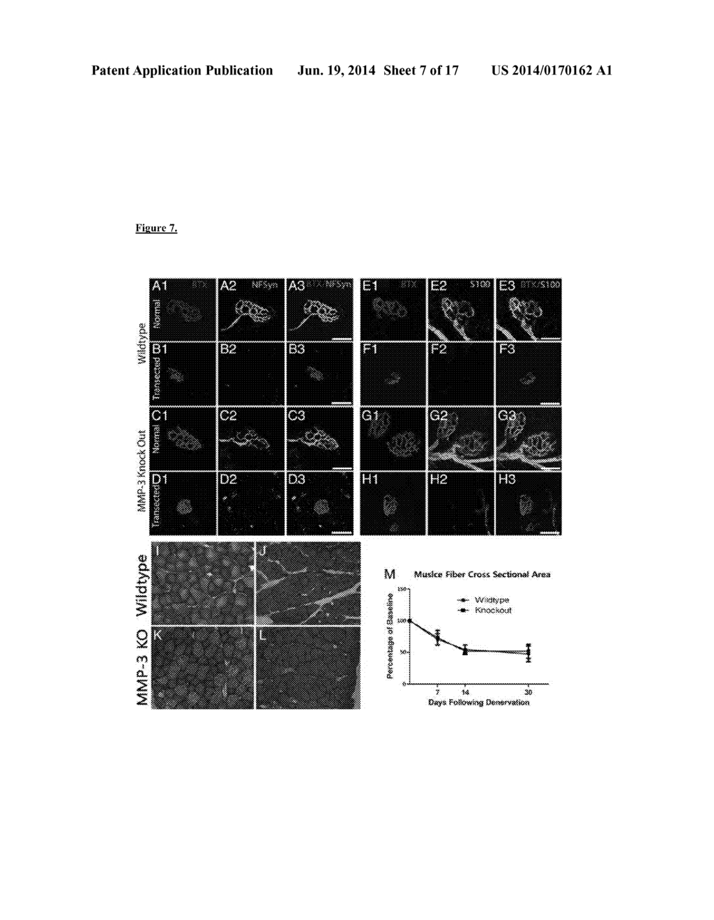 PRESERVATION OF THE NEUROMUSCULAR JUNCTION (NMJ) AFTER TRAUMATIC NERVE     INJURY - diagram, schematic, and image 08