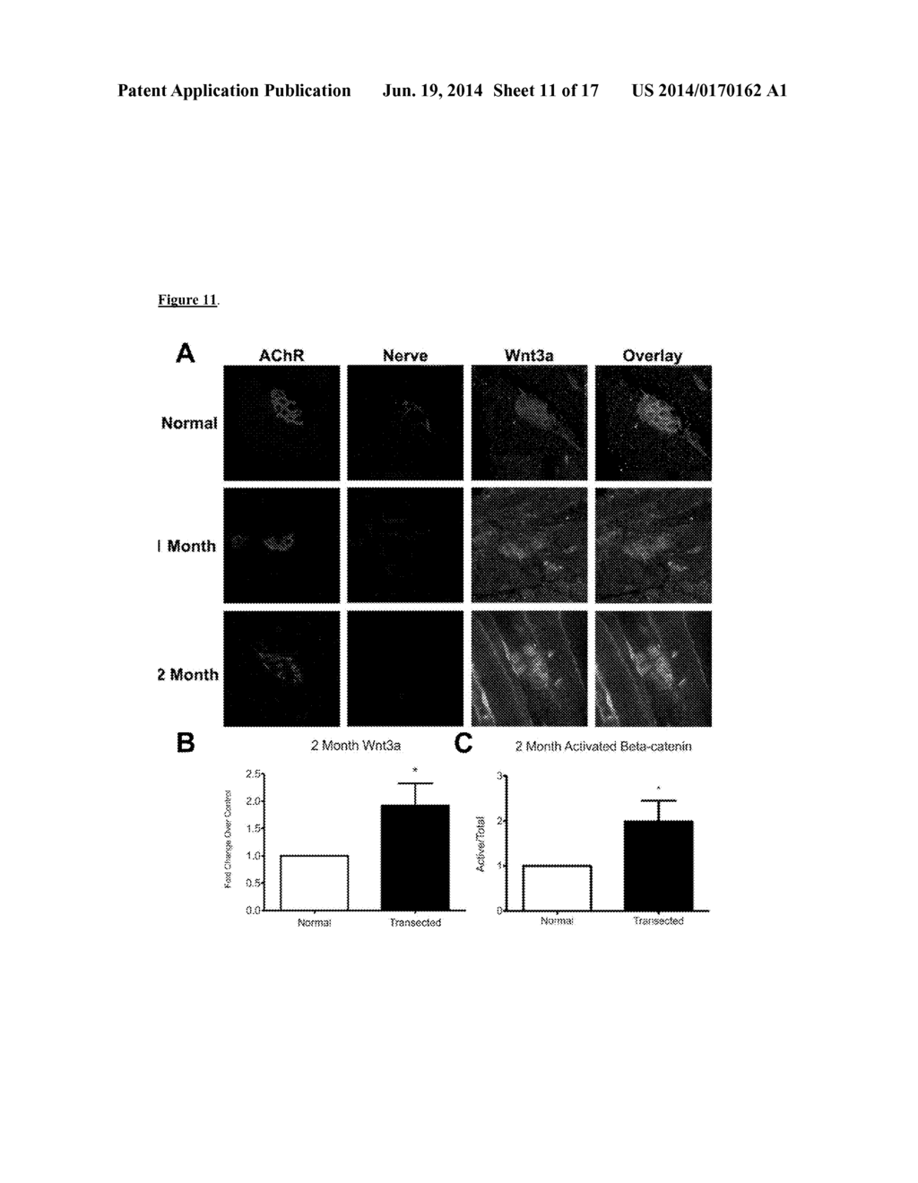 PRESERVATION OF THE NEUROMUSCULAR JUNCTION (NMJ) AFTER TRAUMATIC NERVE     INJURY - diagram, schematic, and image 12