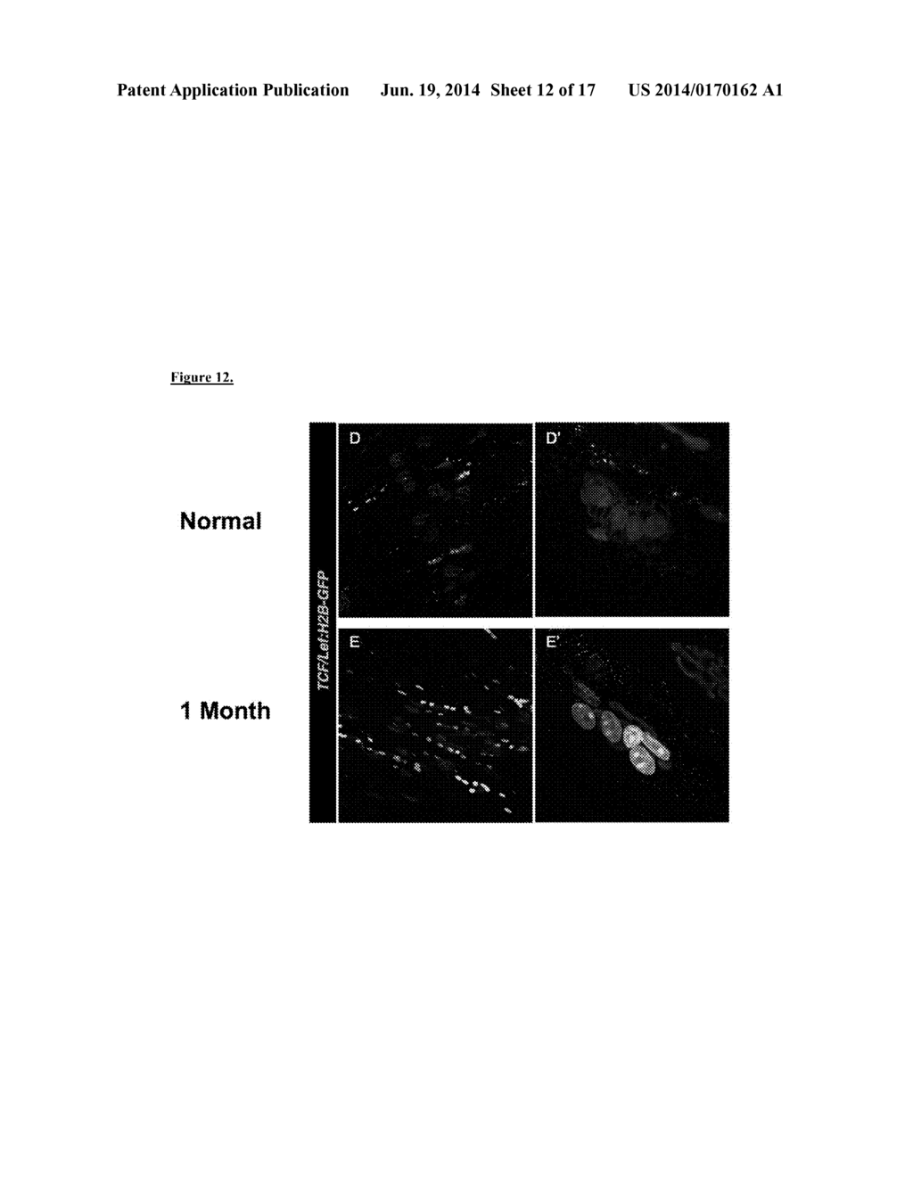 PRESERVATION OF THE NEUROMUSCULAR JUNCTION (NMJ) AFTER TRAUMATIC NERVE     INJURY - diagram, schematic, and image 13