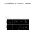 PRESERVATION OF THE NEUROMUSCULAR JUNCTION (NMJ) AFTER TRAUMATIC NERVE     INJURY diagram and image