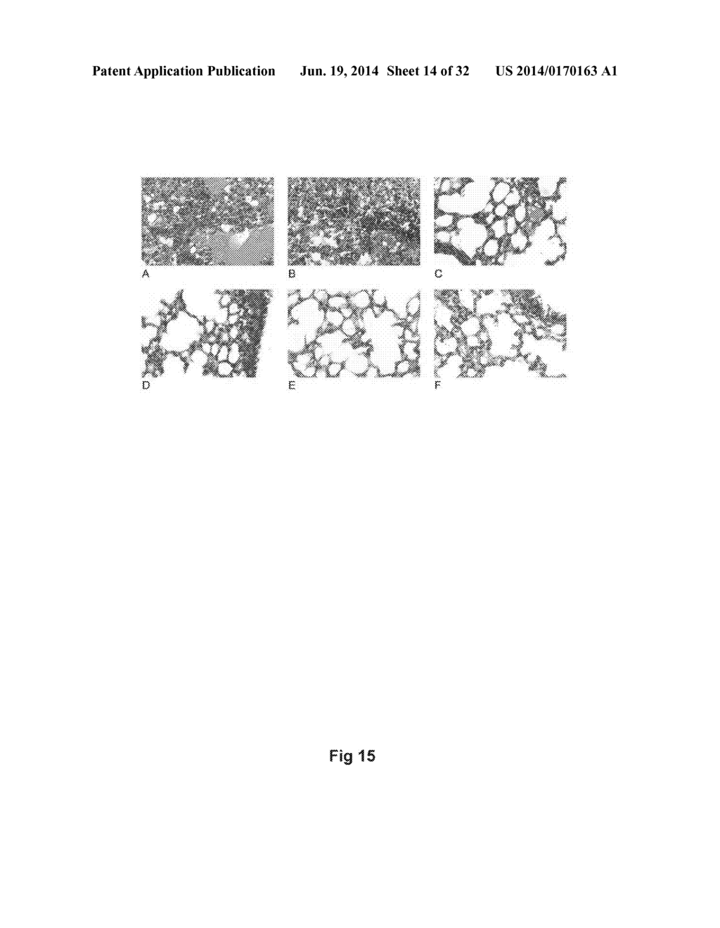 MONOCLONAL ANTIBODIES AGAINST INFLUENZA VIRUS GENERATED BY CYCLICAL     ADMINISTRATION AND USES THEREOF - diagram, schematic, and image 15