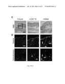 METHODS OF GENERATING HYPER INOS EXPRESSING CELLS AND USES THEREOF diagram and image