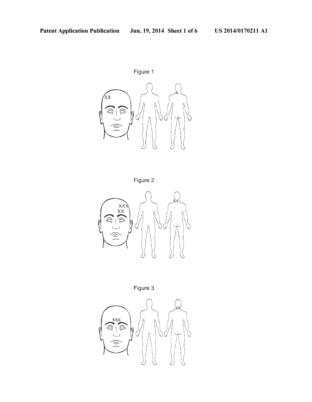 COMPOSITIONS AND METHODS FOR TREATING TRAUMATIC BRAIN INJURY - diagram, schematic, and image 02