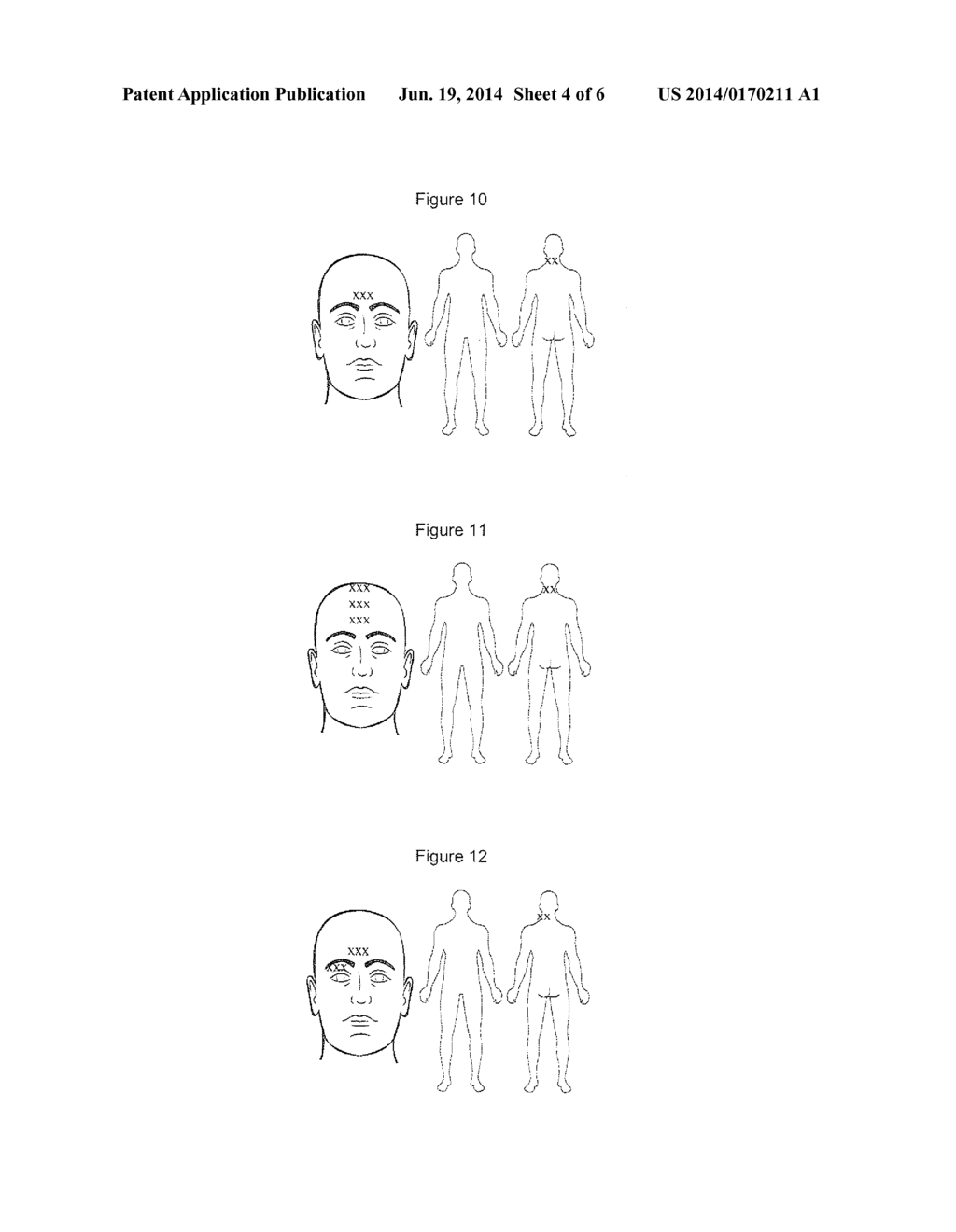 COMPOSITIONS AND METHODS FOR TREATING TRAUMATIC BRAIN INJURY - diagram, schematic, and image 05