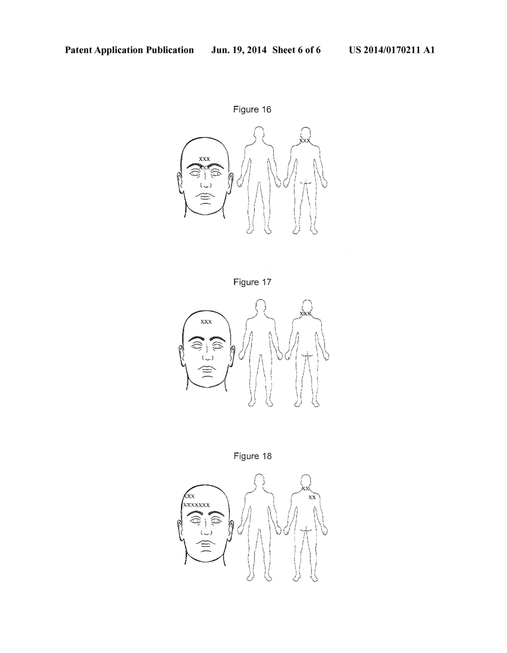 COMPOSITIONS AND METHODS FOR TREATING TRAUMATIC BRAIN INJURY - diagram, schematic, and image 07