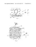 TUFTED FIBROUS WEB diagram and image