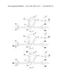 TUFTED FIBROUS WEB diagram and image