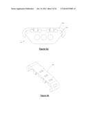 Orthodontic Appliance Anchoring Method and Apparatus diagram and image