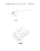 Orthodontic Appliance Anchoring Method and Apparatus diagram and image