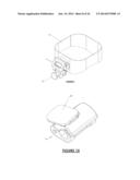 Orthodontic Appliance Anchoring Method and Apparatus diagram and image