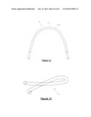 Orthodontic Appliance Anchoring Method and Apparatus diagram and image