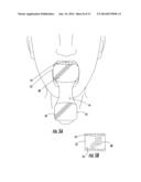 DUAL SURFACE DENTAL DEVICE FOR USE IN INTRAORAL PHOTOGRAPHY diagram and image