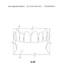 DUAL SURFACE DENTAL DEVICE FOR USE IN INTRAORAL PHOTOGRAPHY diagram and image