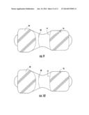 DUAL SURFACE DENTAL DEVICE FOR USE IN INTRAORAL PHOTOGRAPHY diagram and image