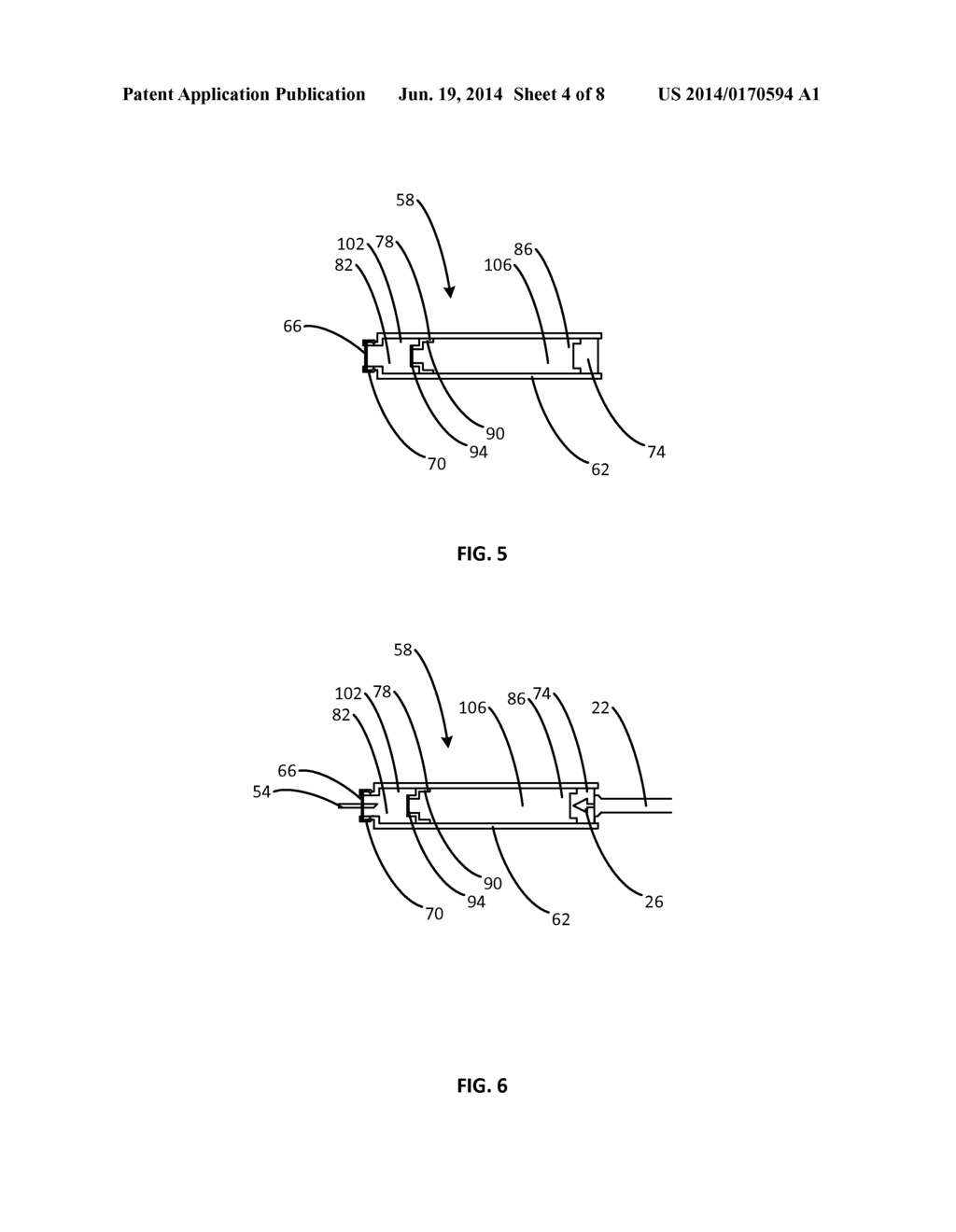 DUAL MEDICAMENT CARPULE FOR DENTAL SYRINGES - diagram, schematic, and image 05