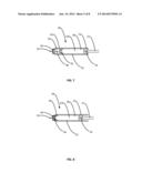 DUAL MEDICAMENT CARPULE FOR DENTAL SYRINGES diagram and image