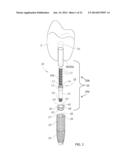 DEVICE, SYSTEM AND METHOD FOR PROSTHODONTIC RESTORATION diagram and image