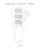 DEVICE, SYSTEM AND METHOD FOR PROSTHODONTIC RESTORATION diagram and image