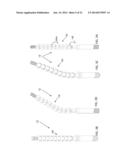 DEVICE, SYSTEM AND METHOD FOR PROSTHODONTIC RESTORATION diagram and image