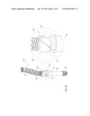 DEVICE, SYSTEM AND METHOD FOR PROSTHODONTIC RESTORATION diagram and image